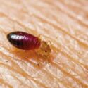 Woman sues golden strike casino for bed bugs